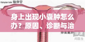 身上出現(xiàn)小囊腫怎么辦？原因、診斷與治療方法全解析