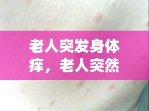 老人突發(fā)身體癢，老人突然渾身癢很長時間了咋回事 
