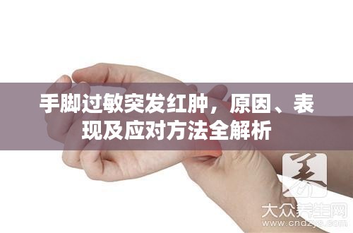 手腳過敏突發(fā)紅腫，原因、表現(xiàn)及應(yīng)對方法全解析