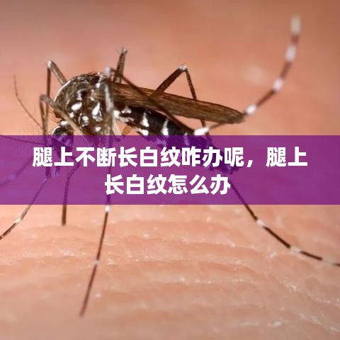 腿上不斷長白紋咋辦呢，腿上長白紋怎么辦 