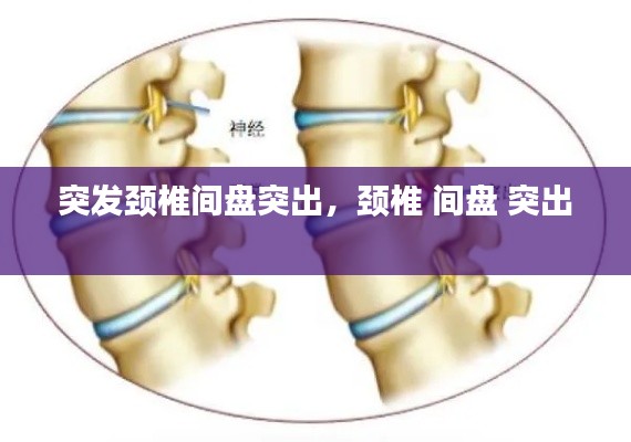 突發(fā)頸椎間盤突出，頸椎 間盤 突出 
