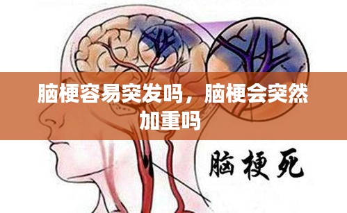 腦梗容易突發(fā)嗎，腦梗會(huì)突然加重嗎 