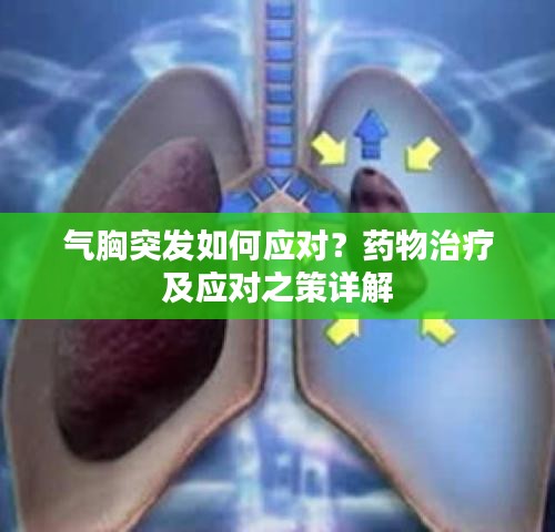 氣胸突發(fā)如何應(yīng)對(duì)？藥物治療及應(yīng)對(duì)之策詳解