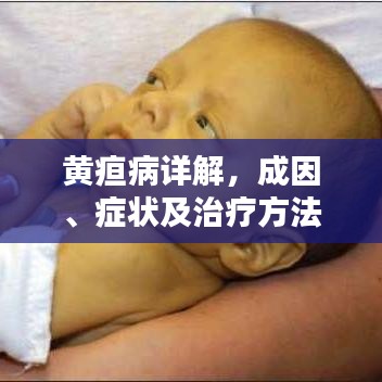 黃疸病詳解，成因、癥狀及治療方法（百度解析，不容錯過）