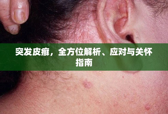 突發(fā)皮癬，全方位解析、應對與關懷指南