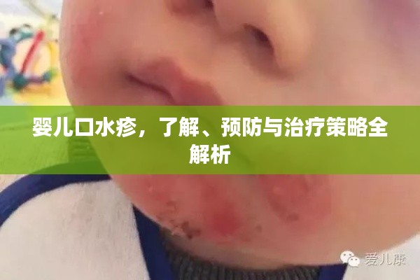 嬰兒口水疹，了解、預(yù)防與治療策略全解析